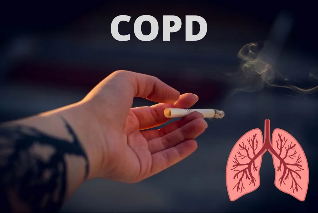 COPD