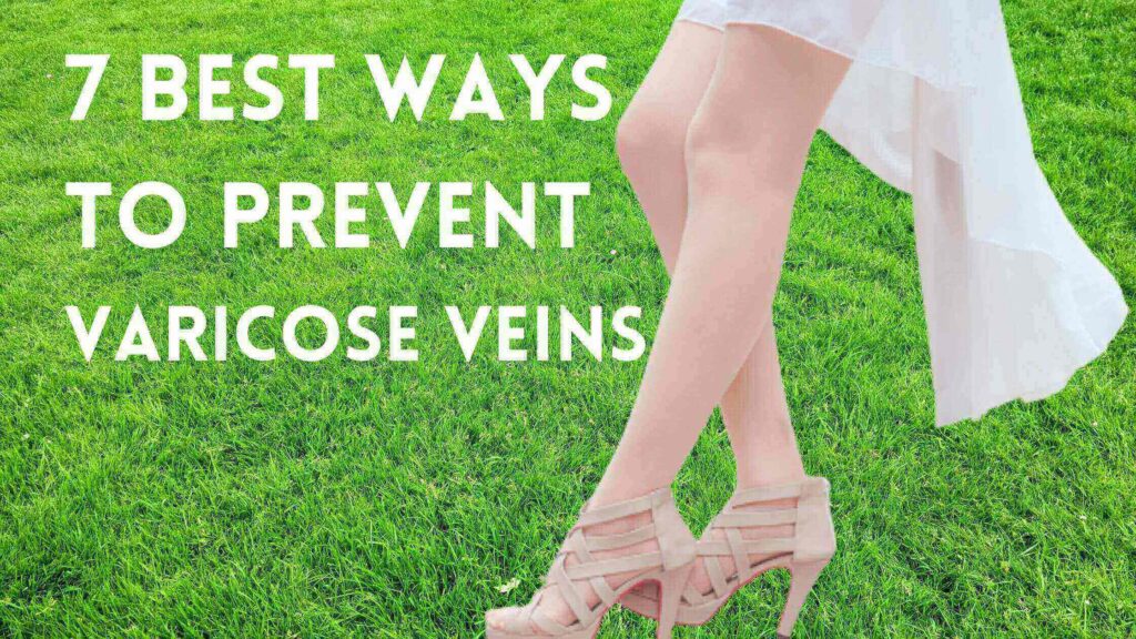 7 Best Ways to Prevent Varicose Veins. Try VARICORIN in 2022.