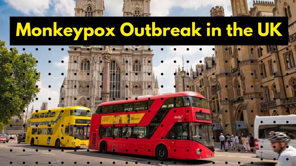 Monkeypox Outbreak in the UK - How to protect yourself