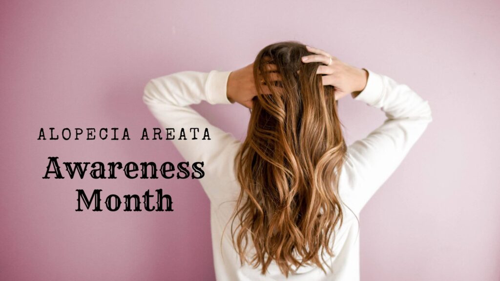 Alopecia Areata FDA Approved Therapy